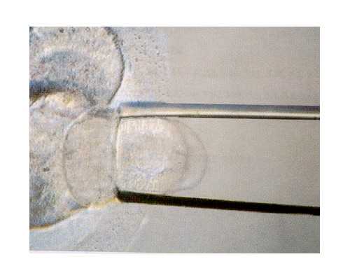 2026秦皇岛试管生男孩医院名单,秦皇岛做试管医院排名?试管最好的医院是哪家？