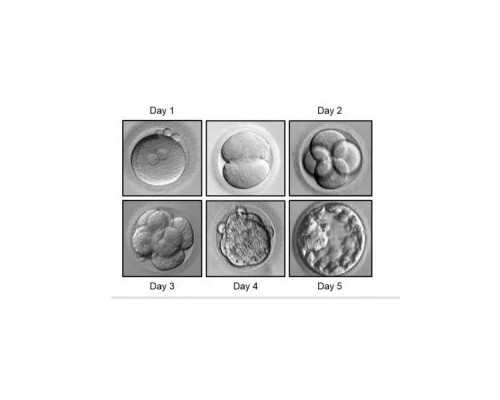 备孕吃什么好生男孩_超级育儿师,月经失调性不孕症有哪些症状