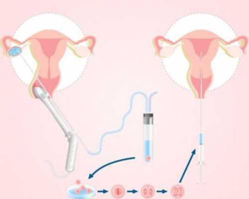 唐山女人代生 唐山妇幼三代试管婴儿三代试管婴儿好不好？ ‘胎儿做四维生长