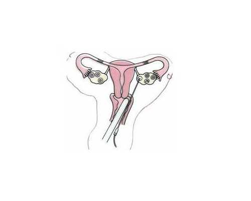 如何自己测试怀孕呢？注意事项有哪些？