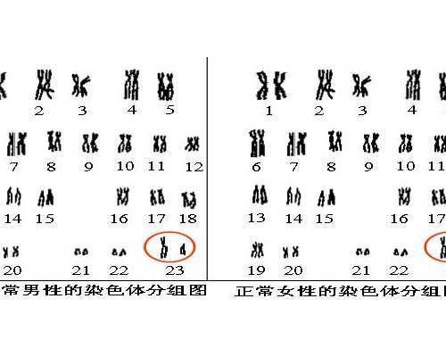 备孕期间吃什么最好_备孕女性要注意什么,女性子宫腺肌症备孕一年都怀不上该