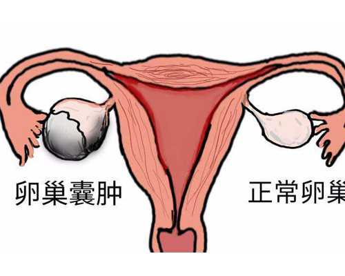 临沂人民医院试管如何 2026临沂市妇幼保健院试管婴儿成功率： ‘生了男孩的第