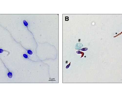 备孕前检查牙齿干嘛_育儿师怎么考,高龄女性备孕小技巧，45岁高龄女性备孕成