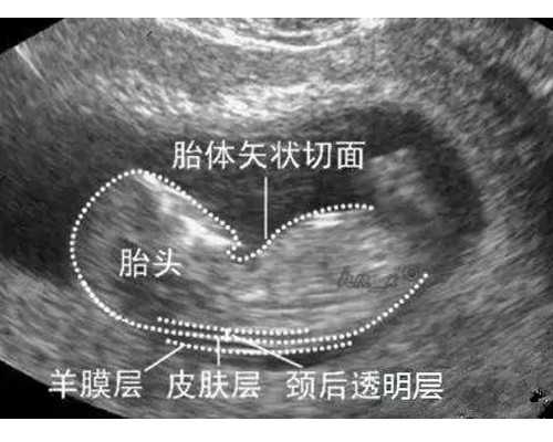 莆田试管选择性别包成功靠谱不,试管婴儿可以选择性别吗莆田九院试管婴儿