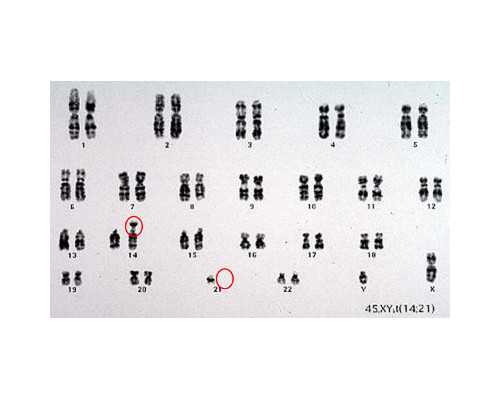 生男孩供卵试管套餐,哈尔滨助孕中介_哈尔滨助孕选