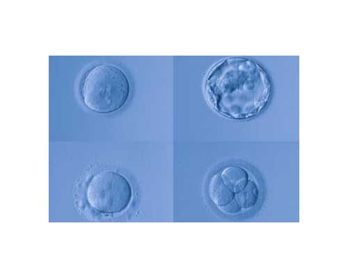 怀孕应注意的事项_幼儿园育儿经验分享,经期喝什么粥缓解疼痛