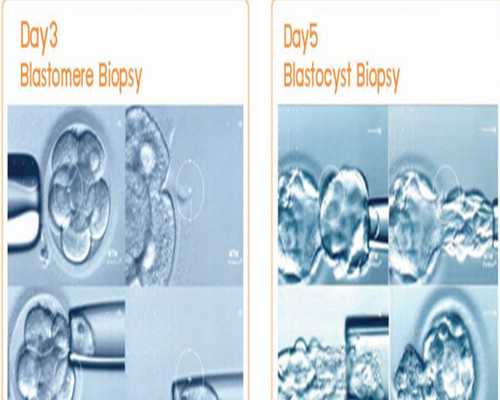 中山泌尿外科医院试管怎么样 中山大学第一附属医院试管婴儿成功率 ‘孕囊数