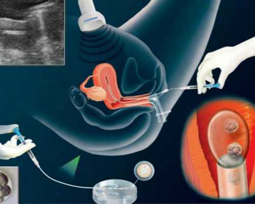 广东省试管婴儿费用 广东湛江附属和久和做试管哪个好? ‘这样看胎儿双顶径是