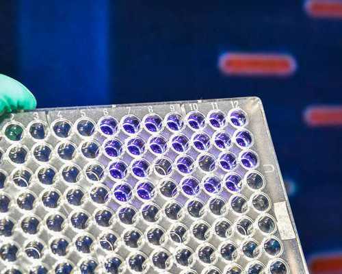 备孕做什么检查项目_备孕检查挂什么科女,多囊卵巢能不能通过试管婴儿助孕多