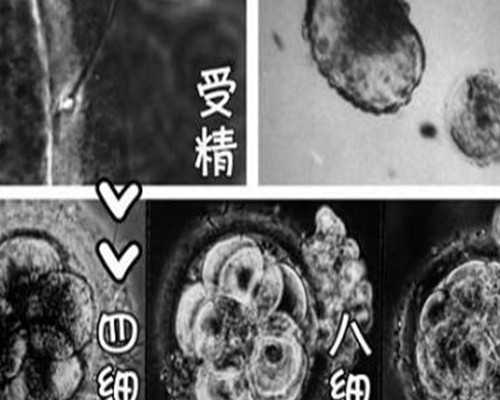 供卵试管要查什么项目,[广西三大助孕公司]梧州助孕骗子公司有哪家