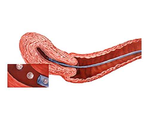 孕前饮食规律的必读指南：预防胎儿畸形、改善妊娠期身体状况与增加受孕机会