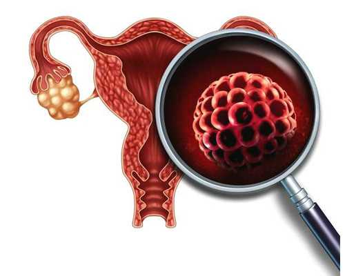 皮下埋植避孕法，皮下埋植避孕法好吗