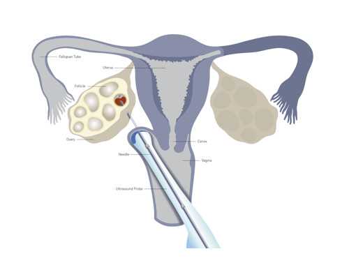 供卵试管借卵机构电话,辽宁三大助孕机构沈阳助孕医院