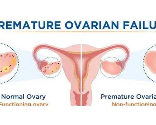 产后抑郁症该怎么办，产后抑郁症的治疗方法