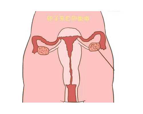 月子里病如何治疗? 理解其内涵才是关键