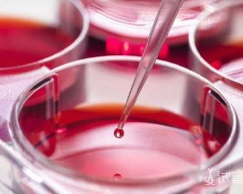 幼师育儿心得_育儿嫂和月嫂区别,多囊卵巢综合症备孕不可以吃黑豆？盲目吃可