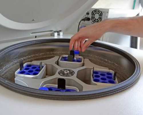 阴道感染与微生态