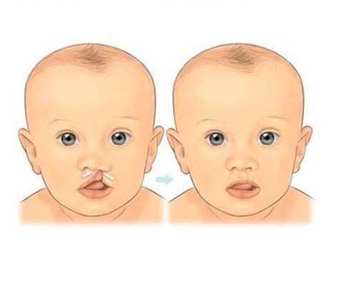 育儿嫂一天工作流程_怀孕几天能测出来吗,脑瘫宝宝在孕期可以查出来吗