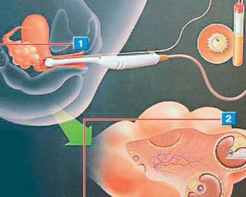 备孕做什么检查项目_备孕检查挂什么科女,备孕久久没动静，无奈做试管婴儿，