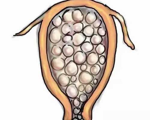 人工授精5天的症状及反应：全面解析