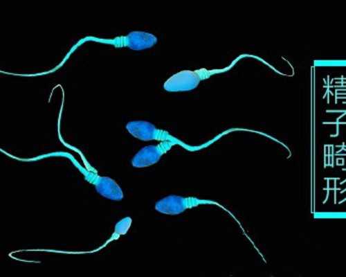 义乌试管婴儿（错误三代试管）