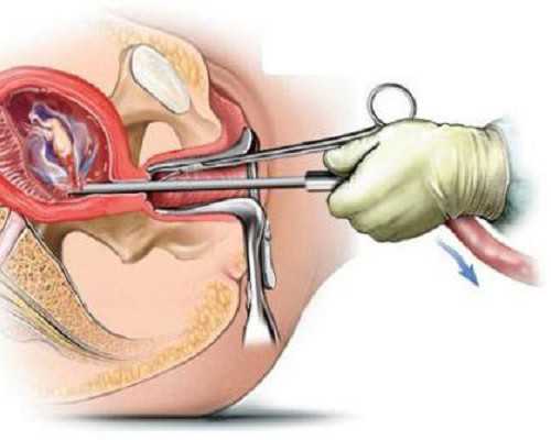 怀孕初期出血_备孕需要注意哪些?,孕期可以打乙肝疫苗么